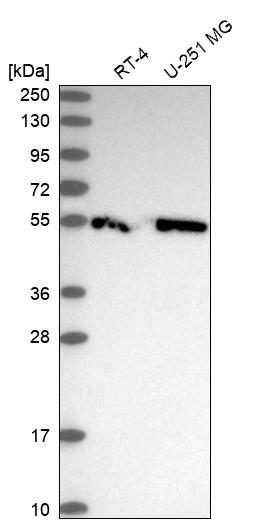 CCDC97 Antibody - BSA Free Western Blot: CCDC97 Antibody - BSA Free [NBP1-91768]