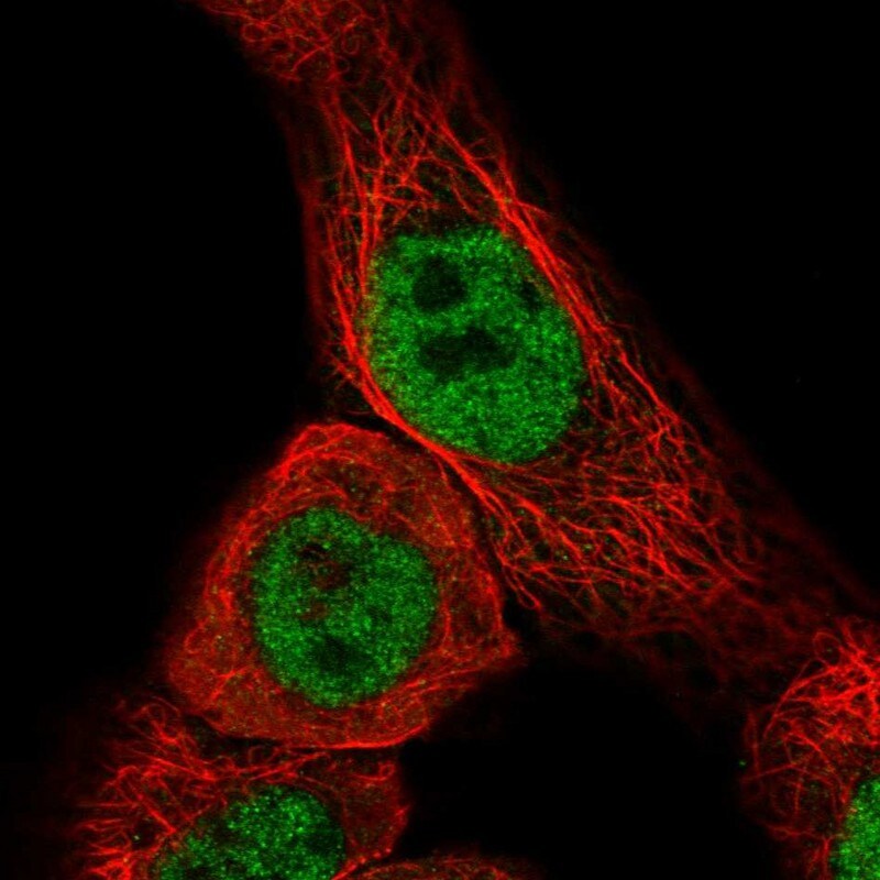 CCDC97 Antibody - BSA Free Immunocytochemistry/ Immunofluorescence: CCDC97 Antibody - BSA Free [NBP1-91768]