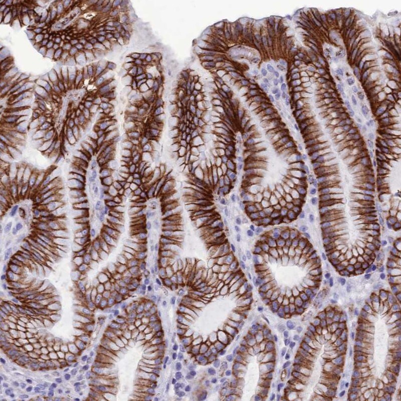 CDC42EP5 Antibody - BSA Free Immunohistochemistry: CDC42EP5 Antibody - BSA Free [NBP1-91773]