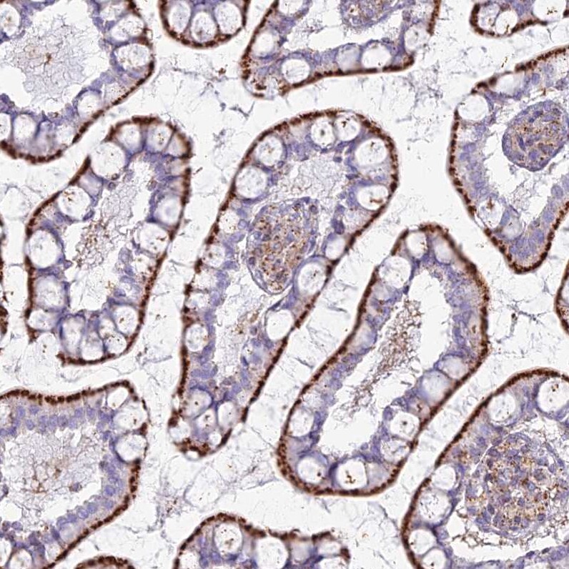 CHMP4B Antibody - BSA Free Immunohistochemistry-Paraffin: CHMP4B Antibody [NBP1-91782]