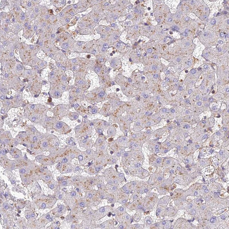 CHMP4B Antibody - BSA Free Immunohistochemistry-Paraffin: CHMP4B Antibody [NBP1-91782]
