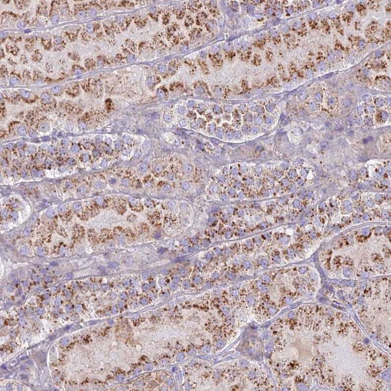 CHMP4B Antibody - BSA Free Immunohistochemistry-Paraffin: CHMP4B Antibody [NBP1-91782]