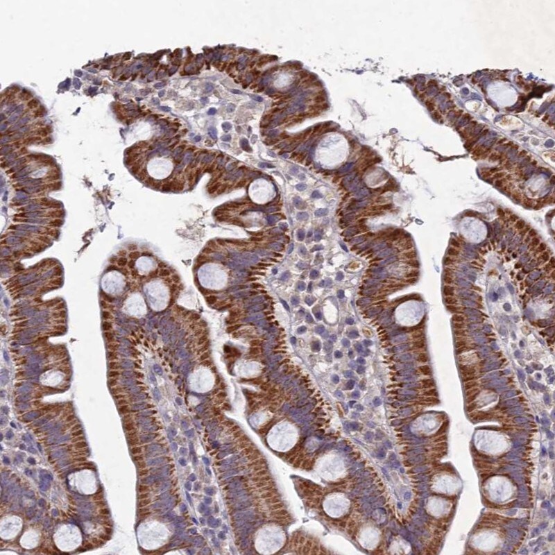 Carbohydrate Sulfotransferase 5/CHST5 Antibody - BSA Free Immunohistochemistry: Carbohydrate Sulfotransferase 5/CHST5 Antibody - BSA Free [NBP1-91785]