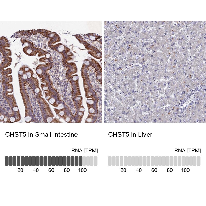 Carbohydrate Sulfotransferase 5/CHST5 Antibody - BSA Free Immunohistochemistry: Carbohydrate Sulfotransferase 5/CHST5 Antibody - BSA Free [NBP1-91785]