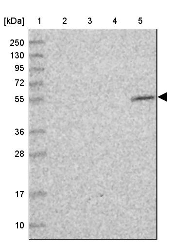 CIRH1A Antibody - BSA Free Western Blot: CIRH1A Antibody - BSA Free [NBP1-91789]
