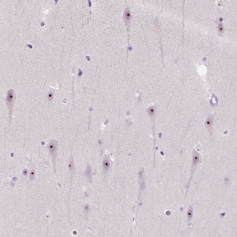 CIRH1A Antibody - BSA Free Immunohistochemistry: CIRH1A Antibody - BSA Free [NBP1-91789]