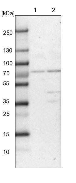 CLCN3 Antibody - BSA Free Western Blot: CLCN3 Antibody - BSA Free [NBP1-91790]