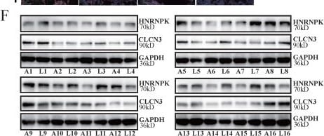 CLCN3 Antibody - BSA Free