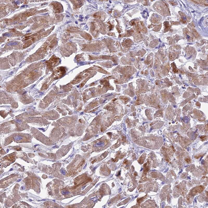 CLIP4 Antibody - BSA Free Immunohistochemistry: CLIP4 Antibody - BSA Free [NBP1-91793]