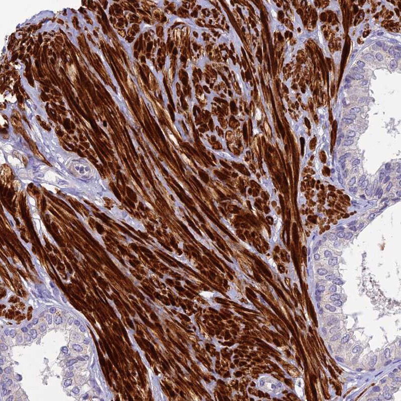 CLIP4 Antibody - BSA Free Immunohistochemistry: CLIP4 Antibody - BSA Free [NBP1-91793]