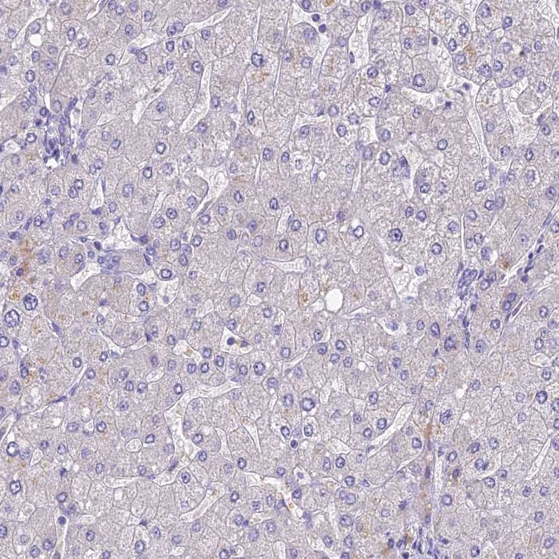 CLIP4 Antibody - BSA Free Immunohistochemistry: CLIP4 Antibody - BSA Free [NBP1-91793]