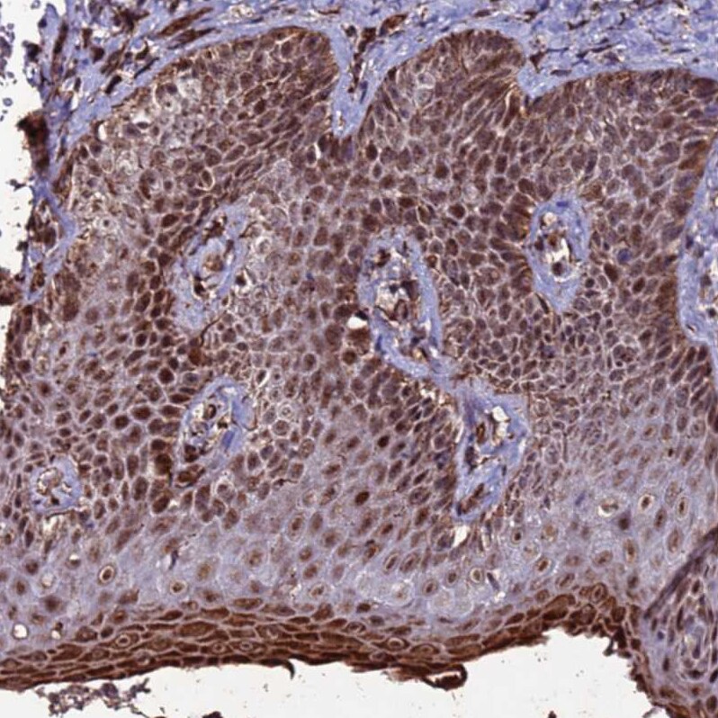 CLK3 Antibody - BSA Free Immunohistochemistry: CLK3 Antibody - BSA Free [NBP1-91794]