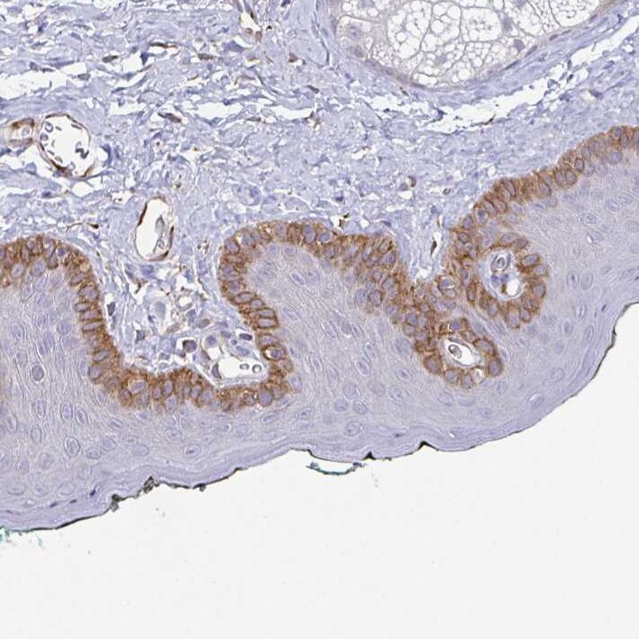 Collagen XVII Antibody - BSA Free Immunohistochemistry: Collagen XVII Antibody - BSA Free [NBP1-91800]