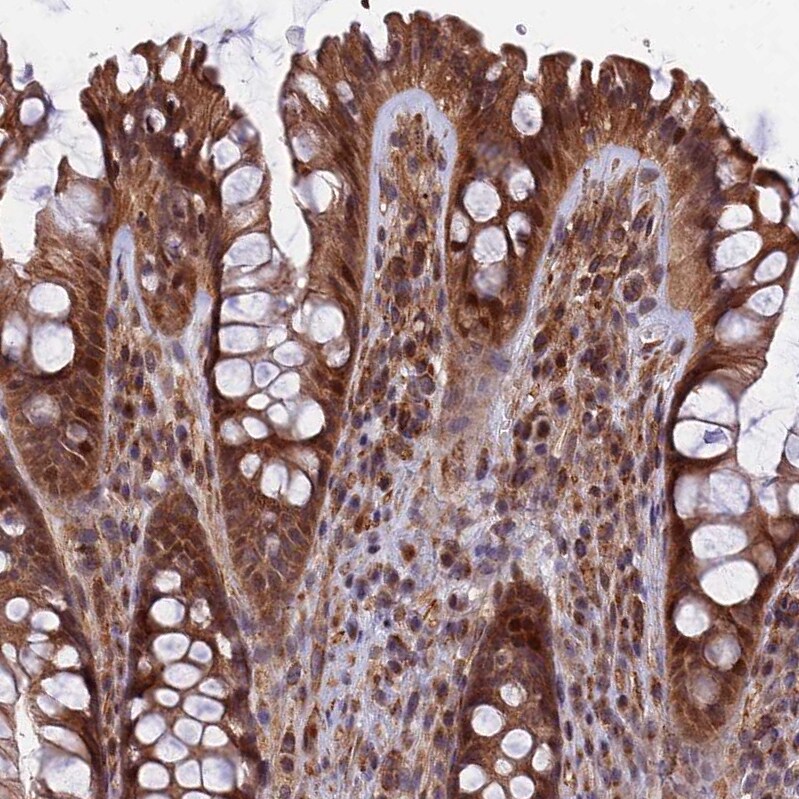 COMMD2 Antibody - BSA Free Immunohistochemistry: COMMD2 Antibody - BSA Free [NBP1-91802]