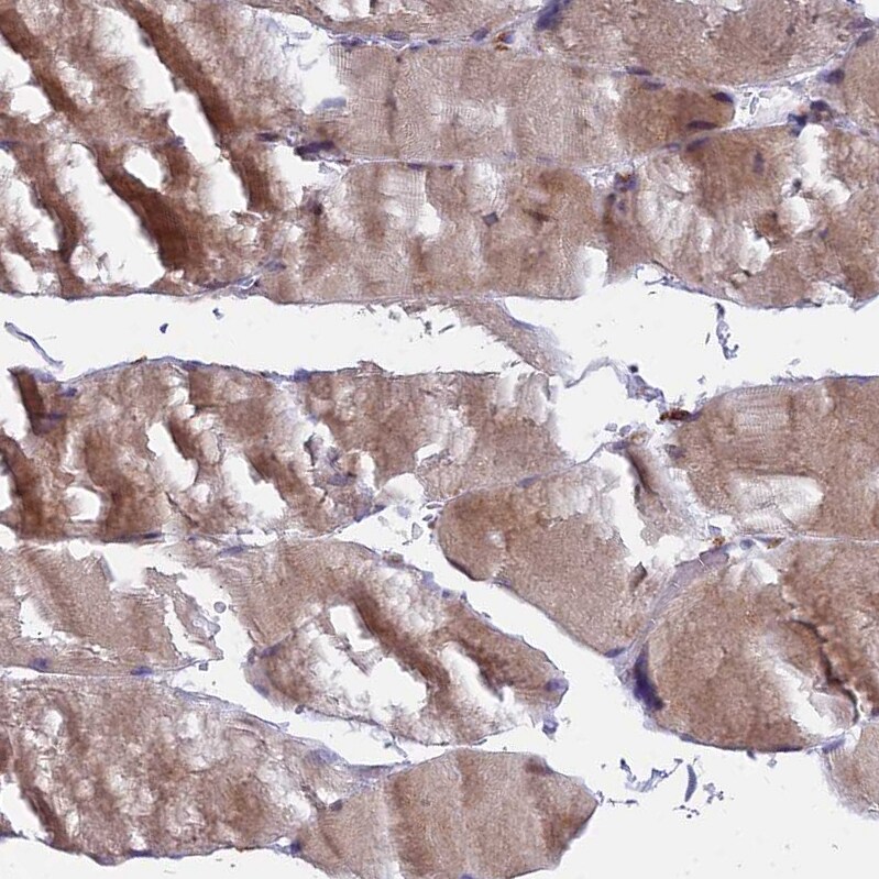 COMMD2 Antibody - BSA Free Immunohistochemistry: COMMD2 Antibody - BSA Free [NBP1-91802]
