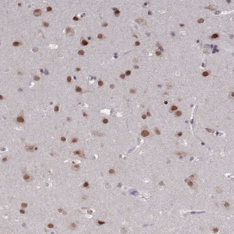 COPS6 Antibody - BSA Free Immunohistochemistry: COPS6 Antibody - BSA Free [NBP1-91805]