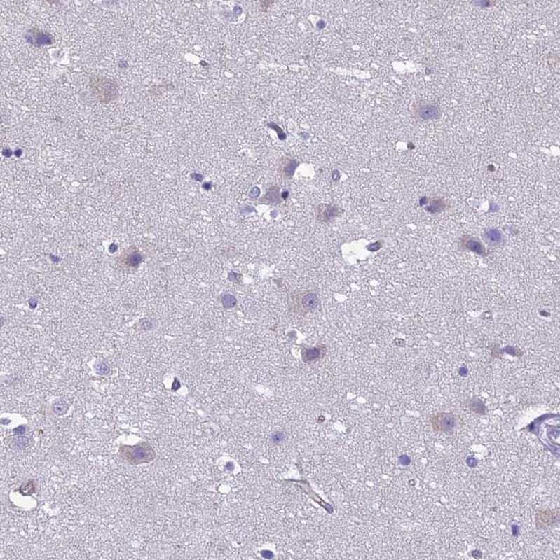 CRB2 Antibody - BSA Free Immunohistochemistry: CRB2 Antibody - BSA Free [NBP1-91809]