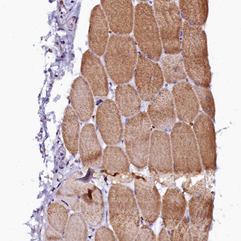 CTDSPL2 Antibody - BSA Free Immunohistochemistry: CTDSPL2 Antibody - BSA Free [NBP1-91814]