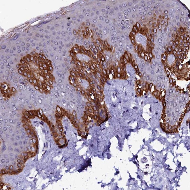 CTDSPL2 Antibody - BSA Free Immunohistochemistry: CTDSPL2 Antibody - BSA Free [NBP1-91814]