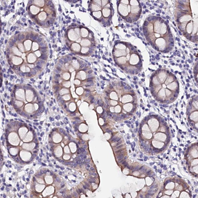 CTDSPL2 Antibody - BSA Free Immunohistochemistry: CTDSPL2 Antibody - BSA Free [NBP1-91814]