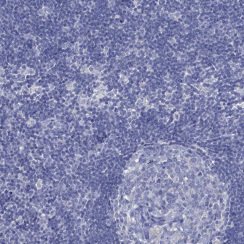 Cytochrome P450 2D6 Antibody - BSA Free Immunohistochemistry: Cytochrome P450 2D6 Antibody - BSA Free [NBP1-91818]