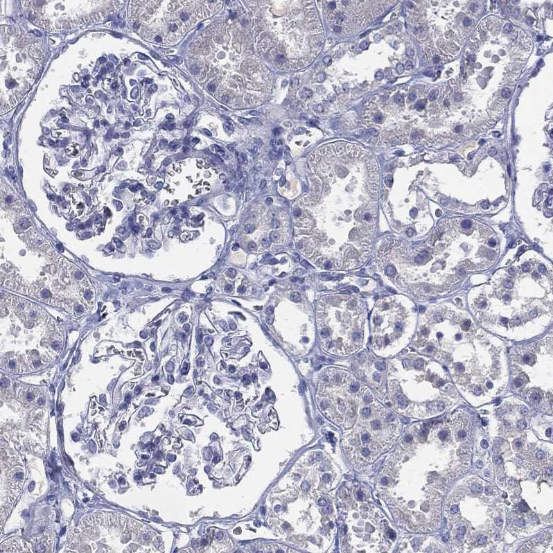 Cytochrome P450 2D6 Antibody - BSA Free Immunohistochemistry: Cytochrome P450 2D6 Antibody - BSA Free [NBP1-91818]