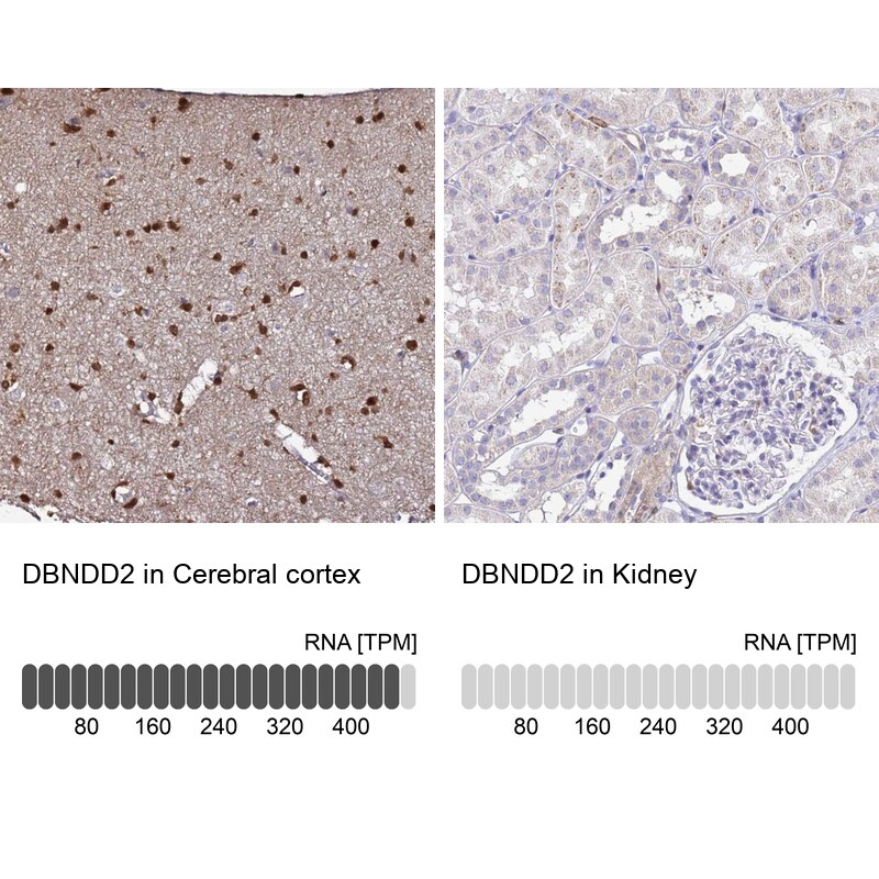 DBNDD2 Antibody - BSA Free Immunohistochemistry: DBNDD2 Antibody - BSA Free [NBP1-91819]