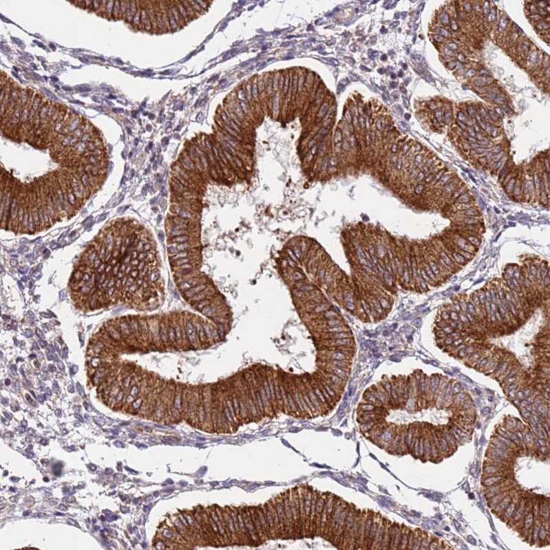 DCAF4 Antibody - BSA Free Immunohistochemistry: DCAF4 Antibody - BSA Free [NBP1-91820]