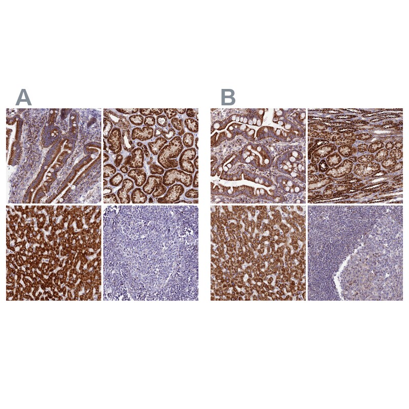 DCI Antibody - BSA Free Immunohistochemistry: DCI Antibody - BSA Free [NBP1-91821]