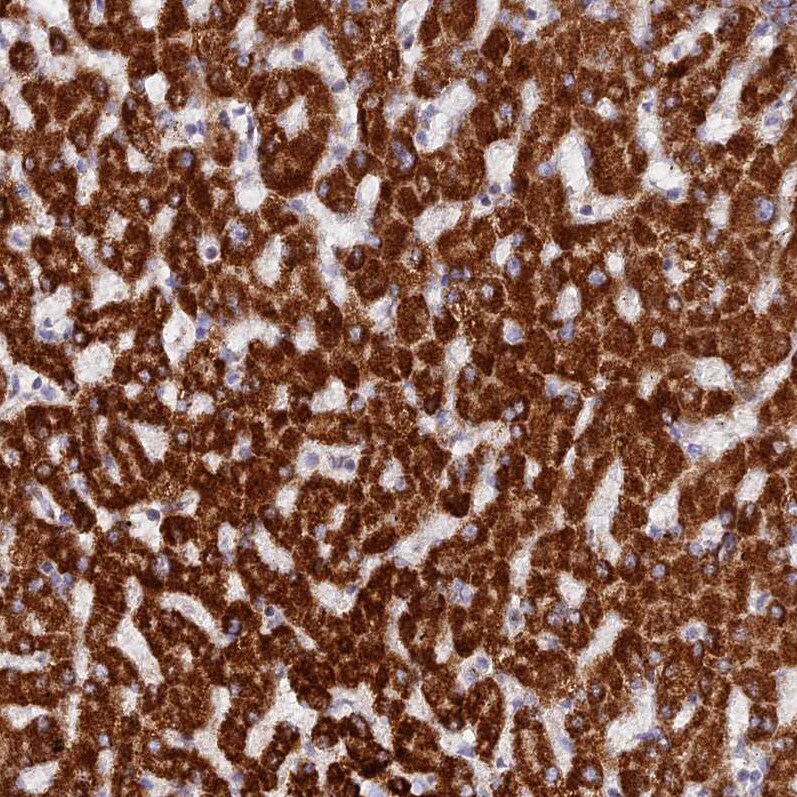 DCI Antibody - BSA Free Immunohistochemistry: DCI Antibody - BSA Free [NBP1-91821]
