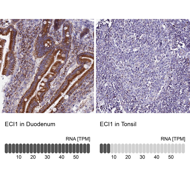 DCI Antibody - BSA Free Immunohistochemistry: DCI Antibody - BSA Free [NBP1-91821]