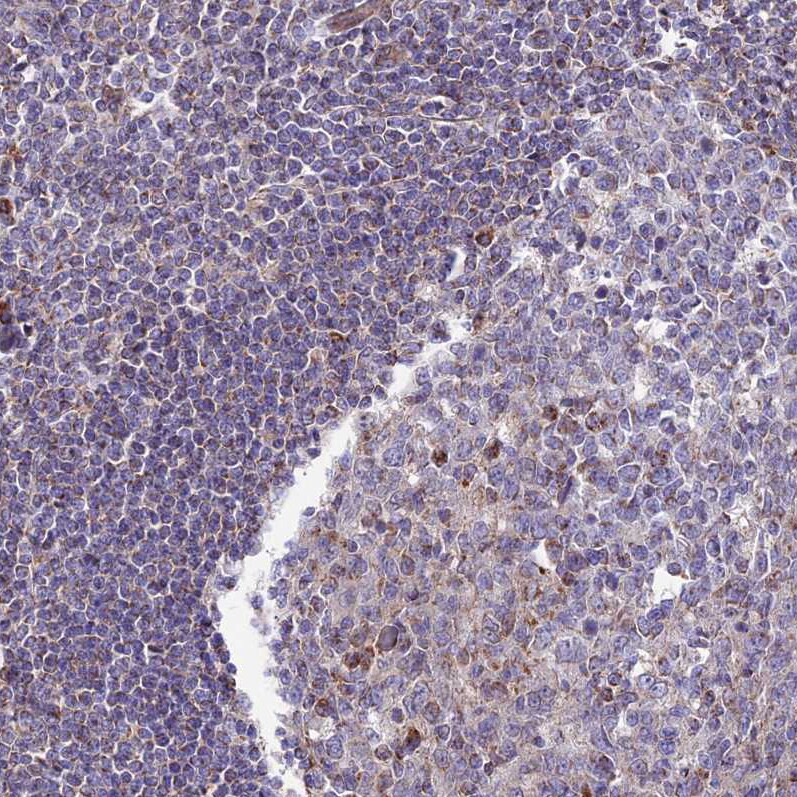 DCI Antibody - BSA Free Immunohistochemistry: DCI Antibody - BSA Free [NBP1-91822]