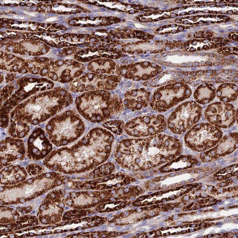 DCI Antibody - BSA Free Immunohistochemistry: DCI Antibody - BSA Free [NBP1-91822]