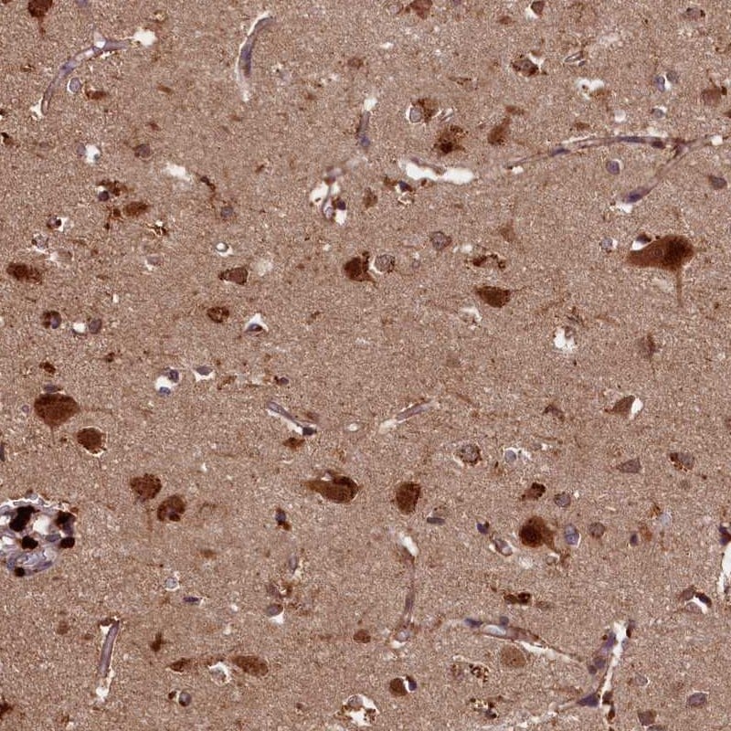 NRAMP2/SLC11A2/DMT1 Antibody - BSA Free Immunohistochemistry-Paraffin: NRAMP2/SLC11A2/DMT1 Antibody [NBP1-91841]