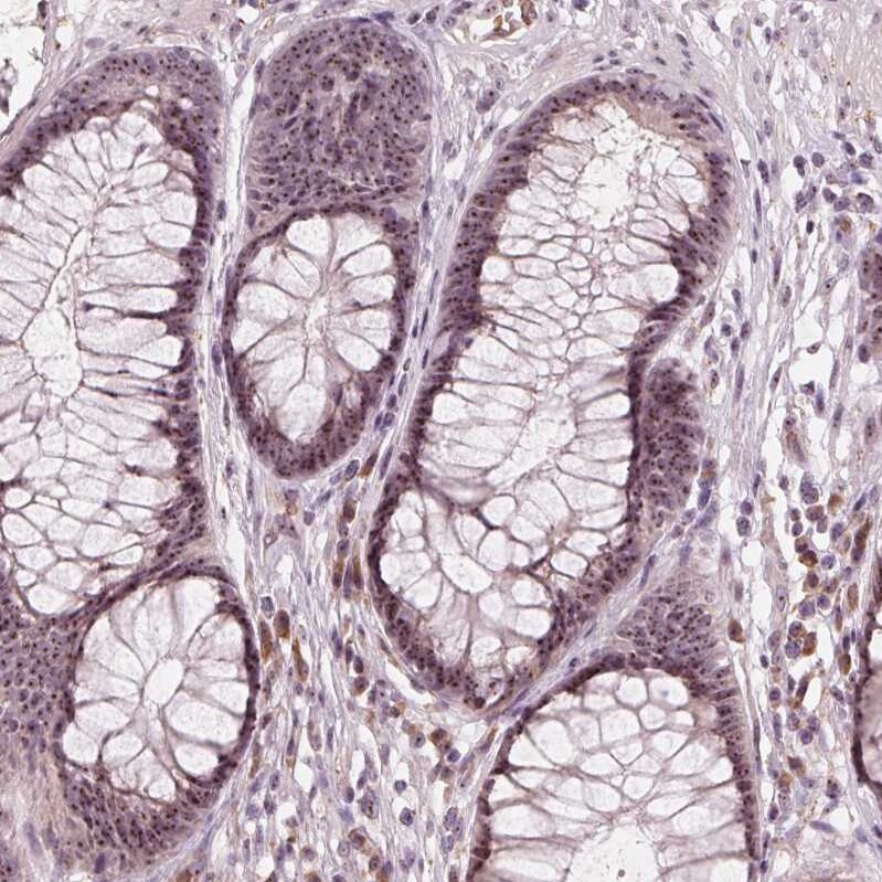 DNTTIP2 Antibody - BSA Free Immunohistochemistry: DNTTIP2 Antibody - BSA Free [NBP1-91845]
