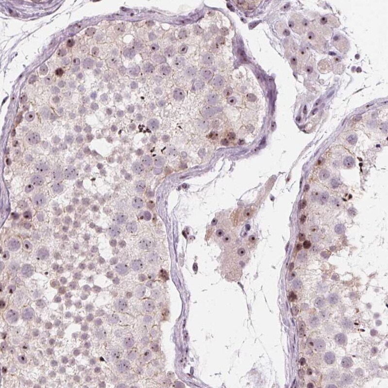 DNTTIP2 Antibody - BSA Free Immunohistochemistry: DNTTIP2 Antibody - BSA Free [NBP1-91845]