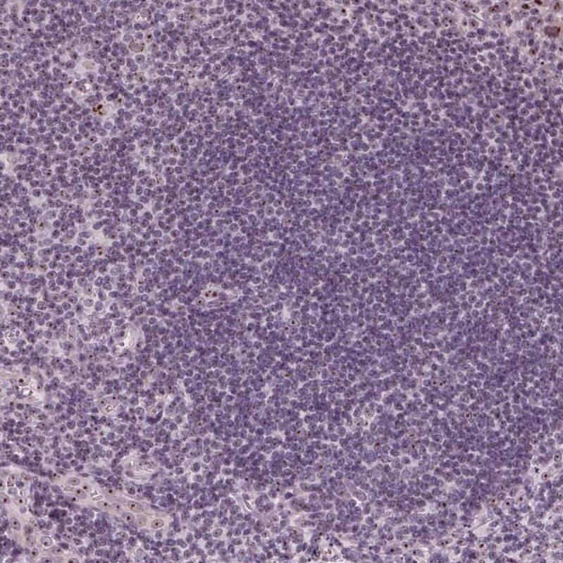 DNTTIP2 Antibody - BSA Free Immunohistochemistry: DNTTIP2 Antibody - BSA Free [NBP1-91845]