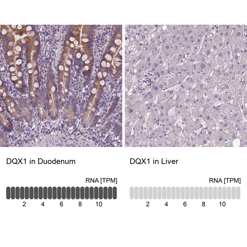 DQX1 Antibody - BSA Free Immunohistochemistry: DQX1 Antibody - BSA Free [NBP1-91849]