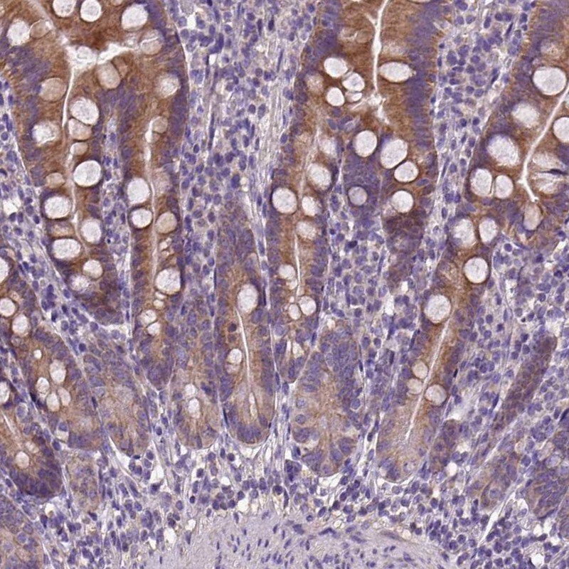 DQX1 Antibody - BSA Free Immunohistochemistry: DQX1 Antibody - BSA Free [NBP1-91849]