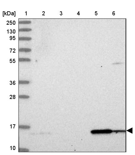 DUSP23 Antibody - BSA Free Western Blot: DUSP23 Antibody - BSA Free [NBP1-91855]