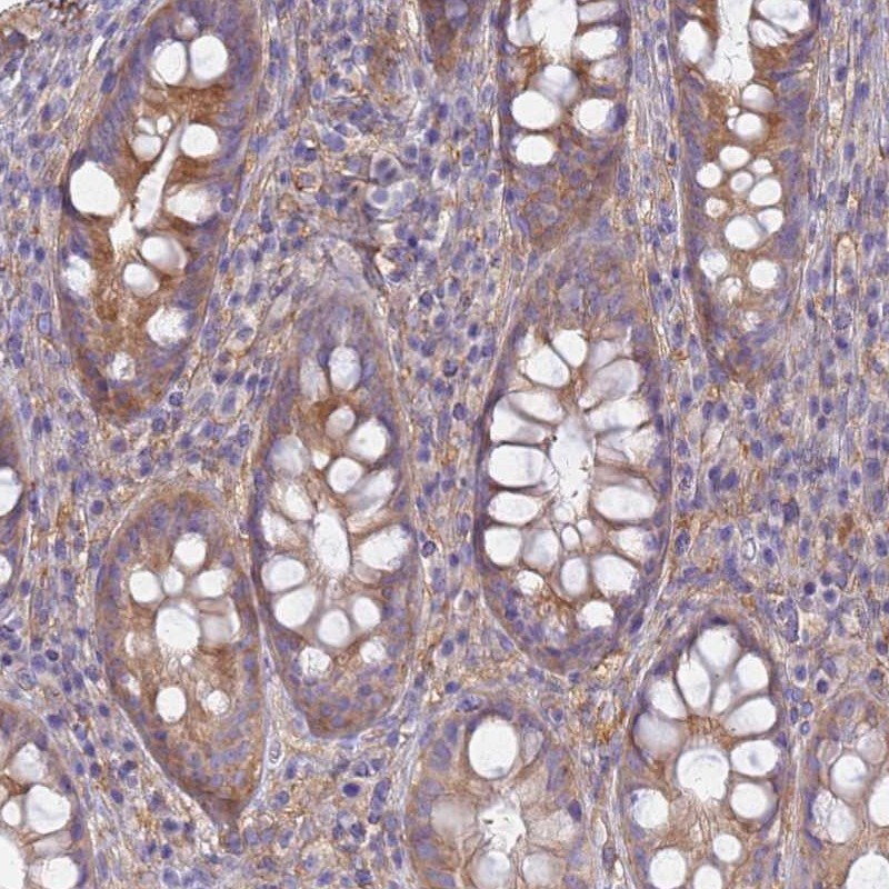 EEA1 Antibody - BSA Free Immunohistochemistry-Paraffin: EEA1 Antibody [NBP1-91859]