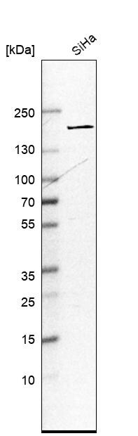 EEA1 Antibody - BSA Free Western Blot: EEA1 Antibody - BSA Free [NBP1-91859]