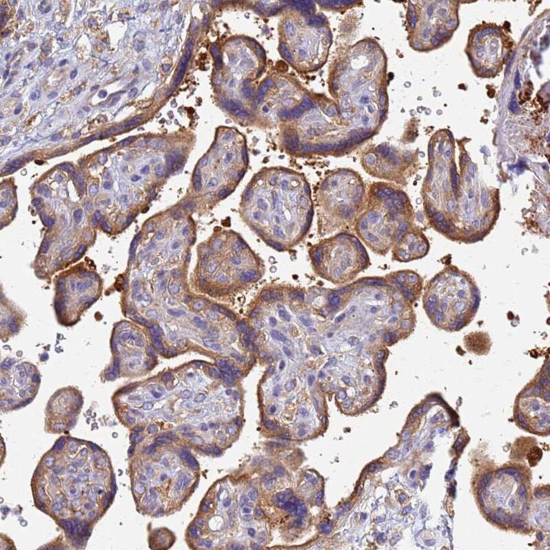 EEA1 Antibody - BSA Free Immunohistochemistry: EEA1 Antibody - BSA Free [NBP1-91860]