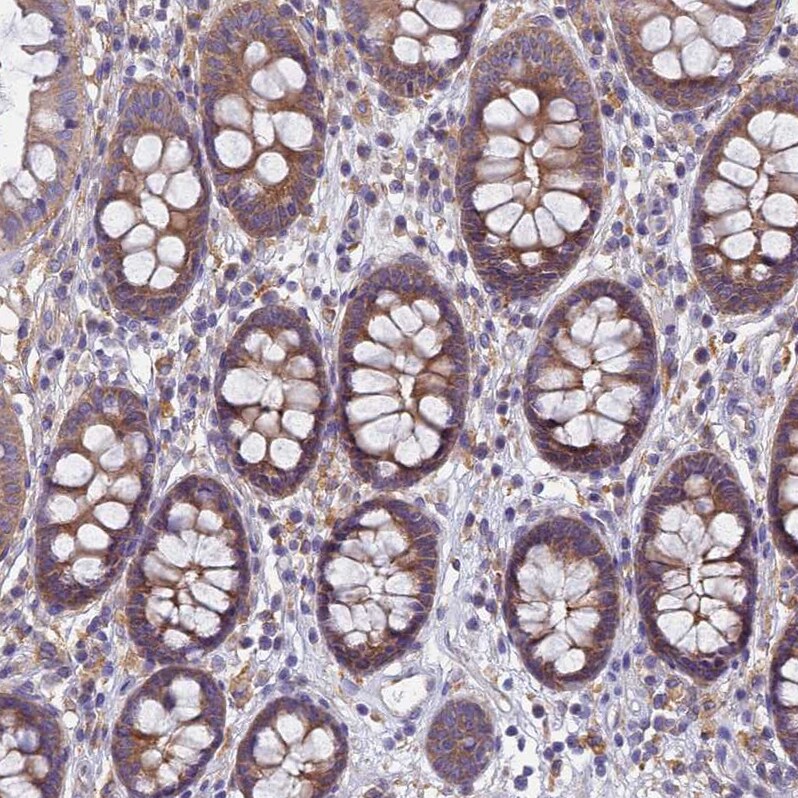 EEA1 Antibody - BSA Free Immunohistochemistry: EEA1 Antibody - BSA Free [NBP1-91860]