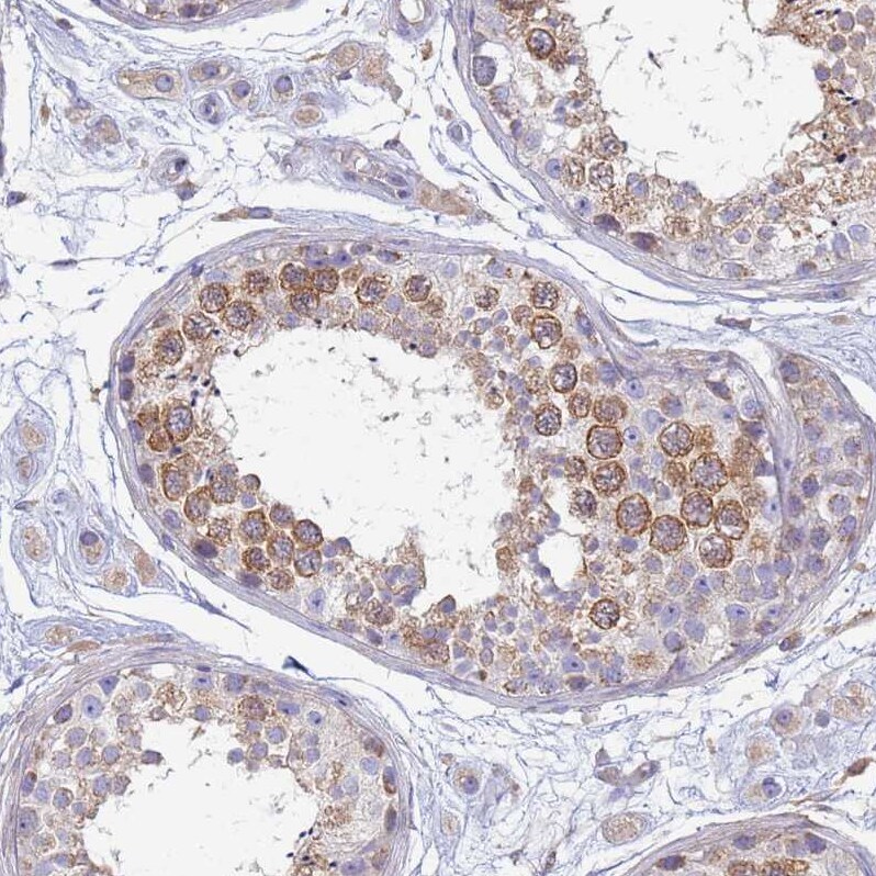 EEA1 Antibody - BSA Free Immunohistochemistry: EEA1 Antibody - BSA Free [NBP1-91860]