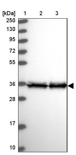 EEF1D Antibody - BSA Free Western Blot: EEF1D Antibody - BSA Free [NBP1-91861]