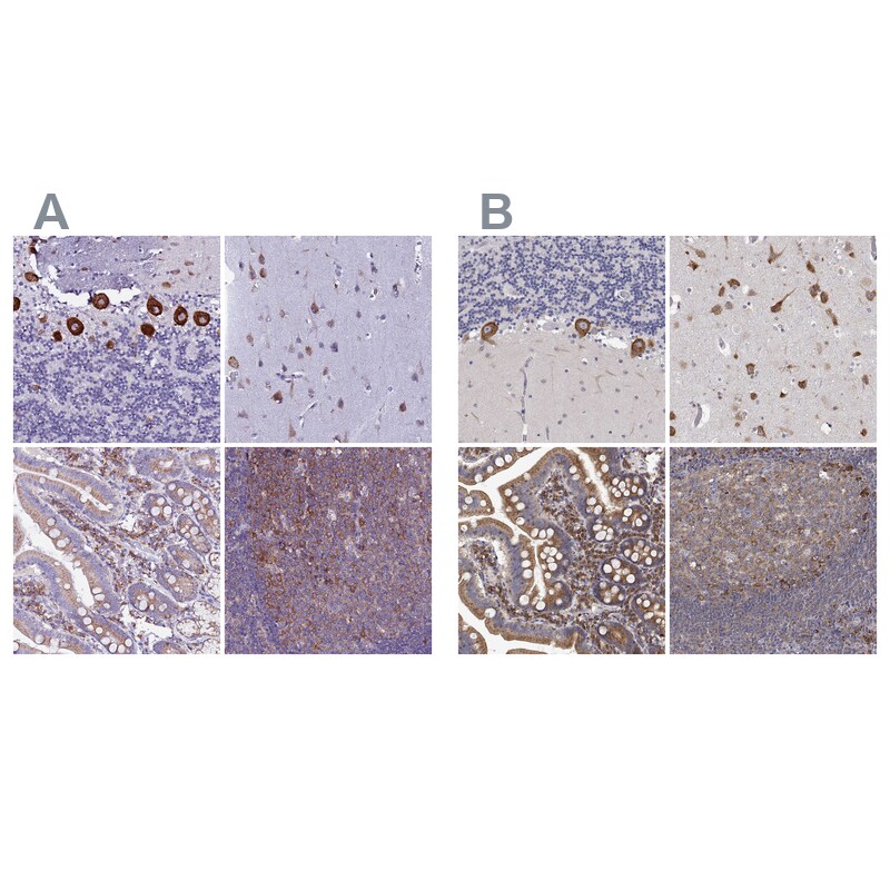 EEF1G Antibody - BSA Free Immunohistochemistry-Paraffin: EEF1G Antibody [NBP1-91862]