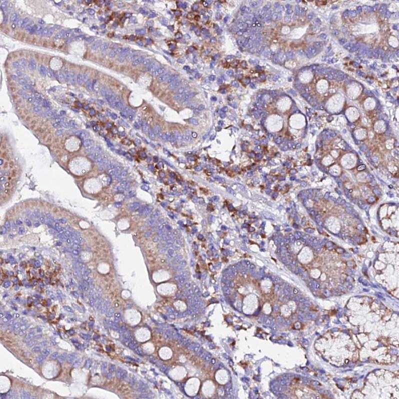 EEF1G Antibody - BSA Free Immunohistochemistry: EEF1G Antibody - BSA Free [NBP1-91862]