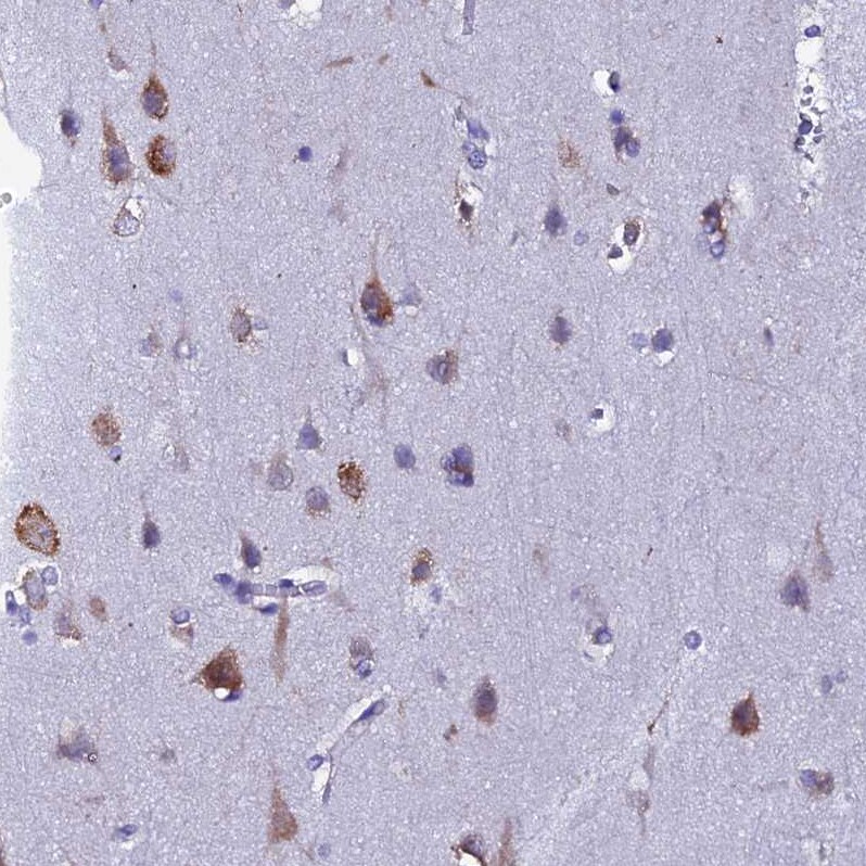 EEF1G Antibody - BSA Free Immunohistochemistry: EEF1G Antibody - BSA Free [NBP1-91862]