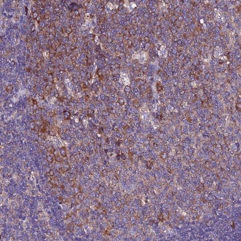 EEF1G Antibody - BSA Free Immunohistochemistry: EEF1G Antibody - BSA Free [NBP1-91862]